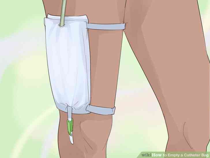 Image intitulée Vide un Cathéter Sac à l